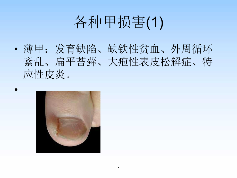 甲疾病医学PPT课件.ppt_第3页