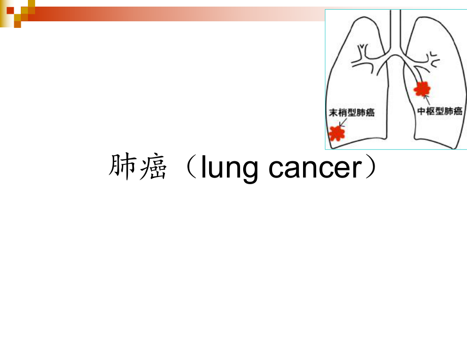 肺癌医学PPT课件.ppt_第1页