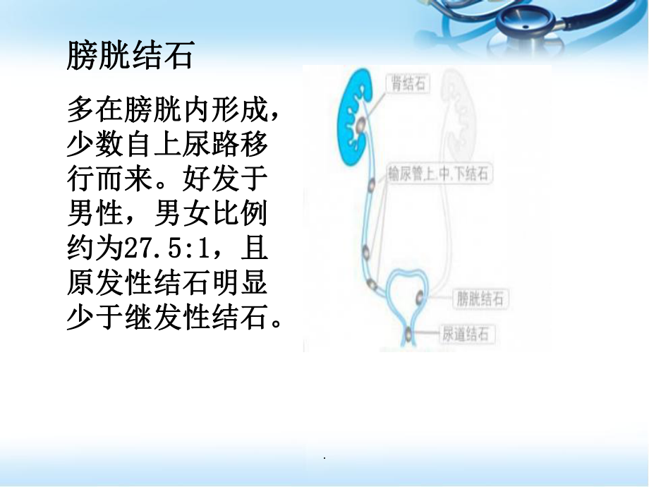 膀胱结石医学PPT课件.ppt_第3页