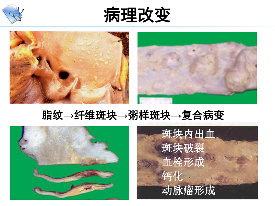 病理生理学AS.ppt_第3页