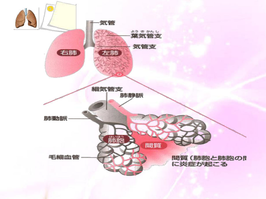 肺炎病人的护理.ppt_第3页