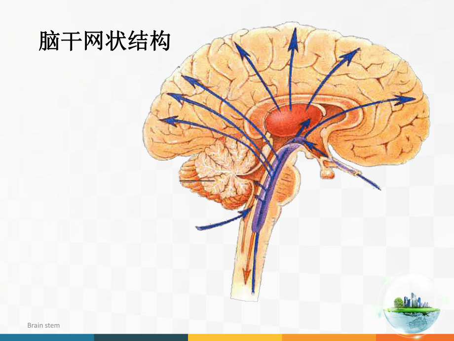 脑干病变综合征.ppt_第3页