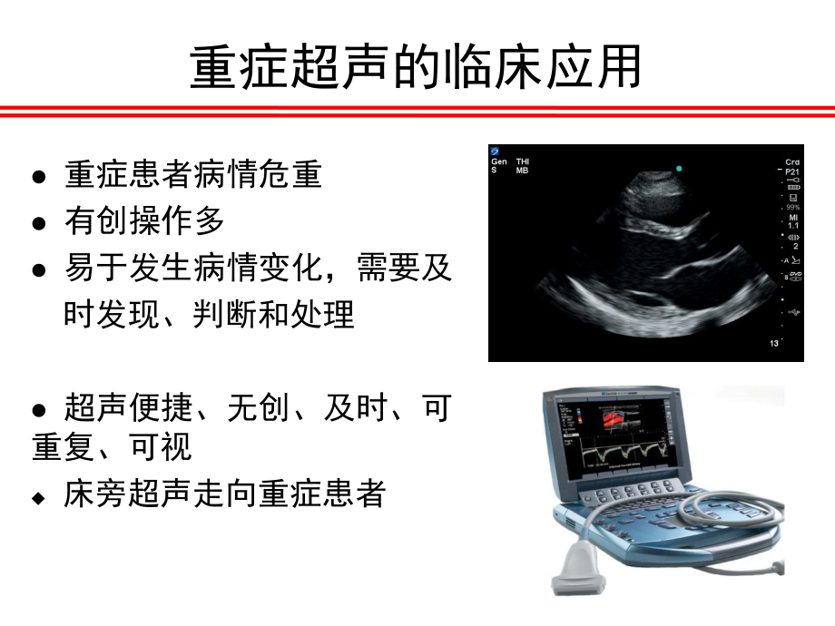 重症超声的临床应用.pptx_第2页