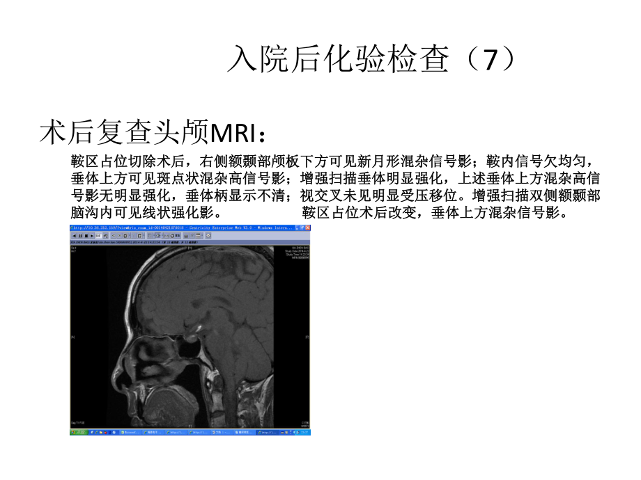 【医学课件】垂体占位PPT.pptx_第2页