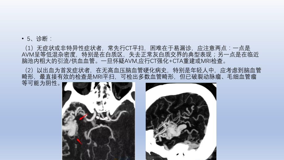 常见脑血管畸形的影像学表现.pptx_第3页