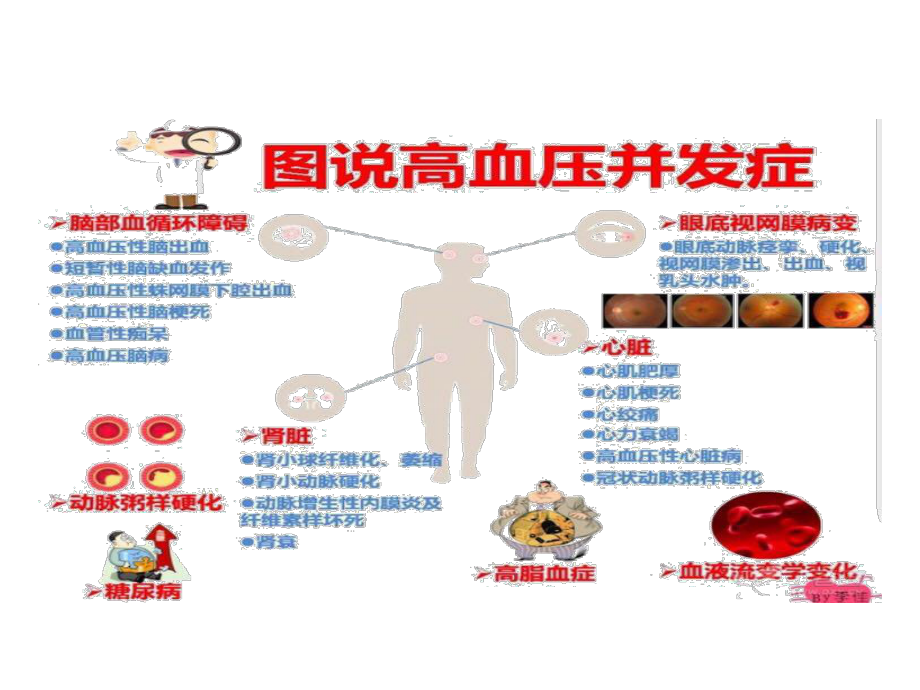 高血压治疗的误区.pptx_第3页