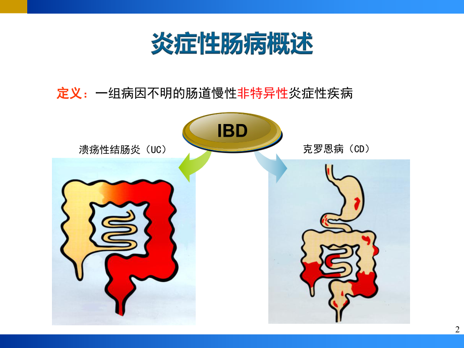 炎症性肠病(IBD)PPT.pptx_第2页