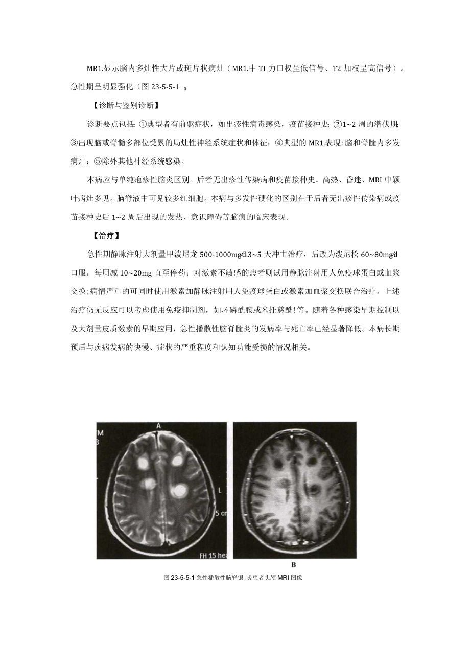 急性播散性脑脊髓炎诊疗规范2023版.docx_第2页