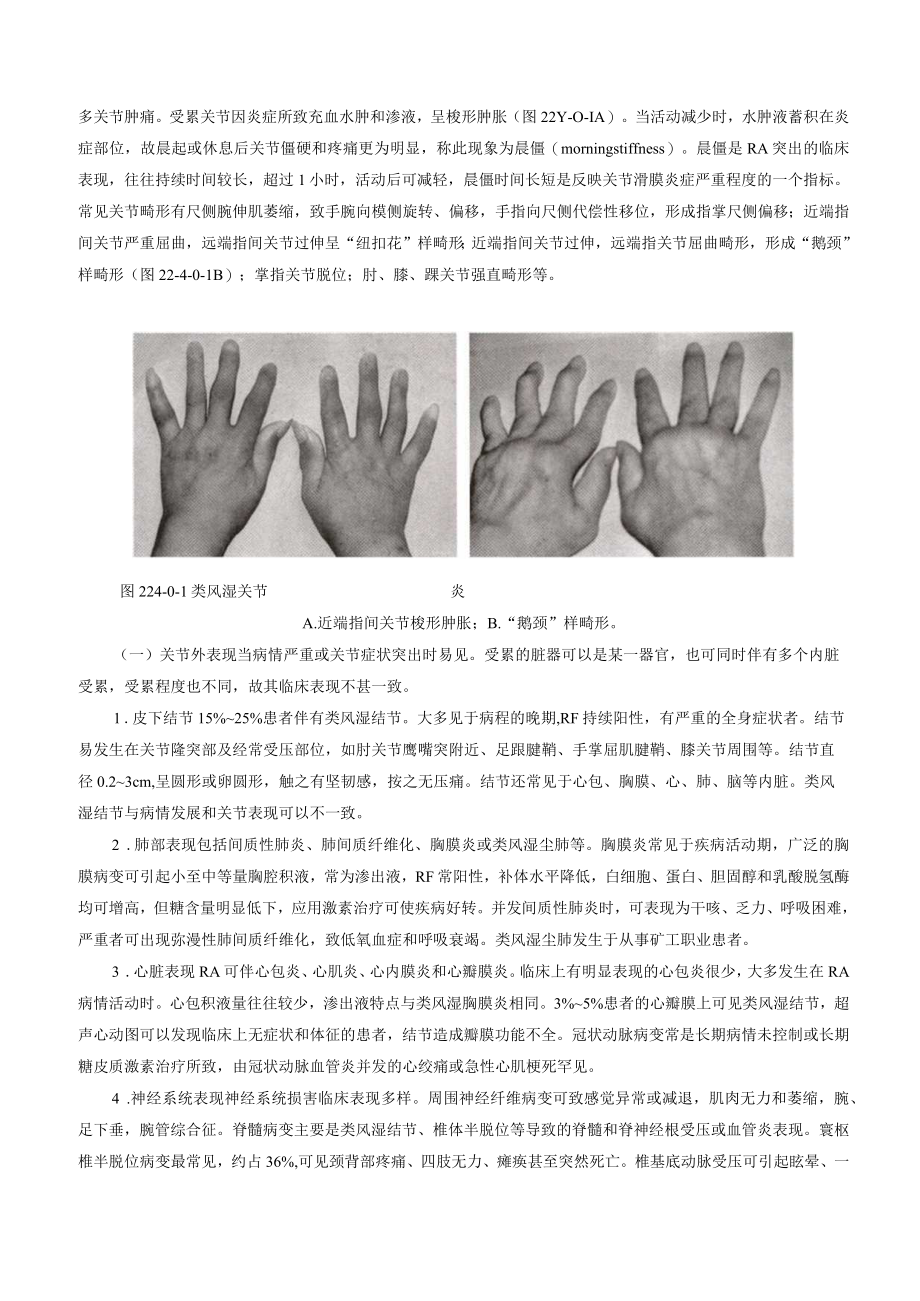 类风湿关节炎诊疗规范2023版.docx_第3页