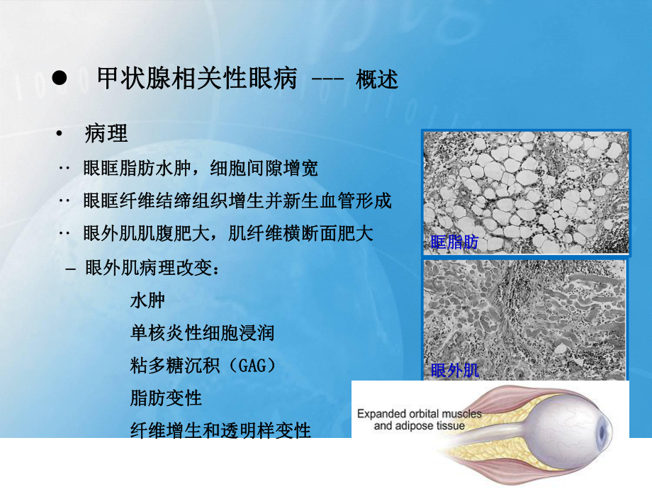 甲状腺相关性眼病影像学表现.pptx_第3页