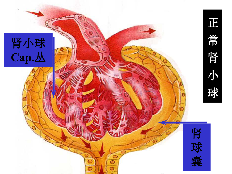 肾炎病理新.ppt_第2页