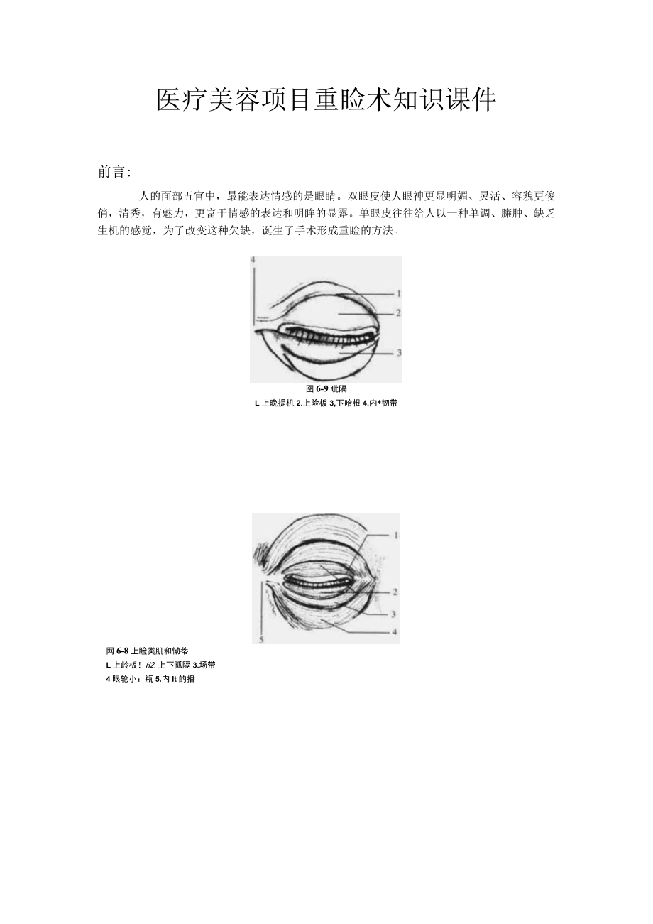 医疗美容项目重睑术知识课件.docx_第1页