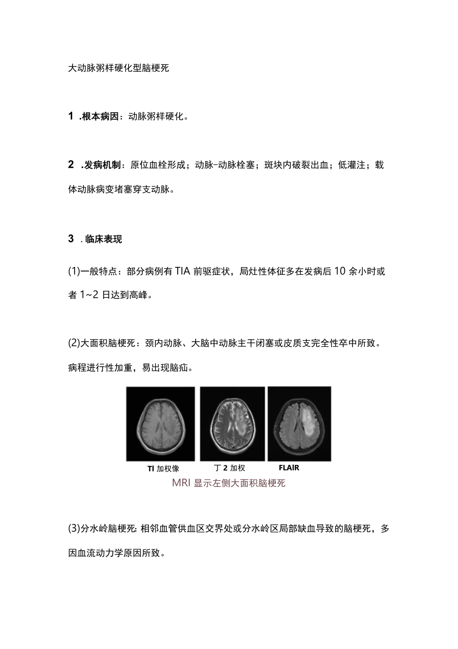 2023脑梗死常见临床类型特点及诊断标准（全文）.docx_第2页