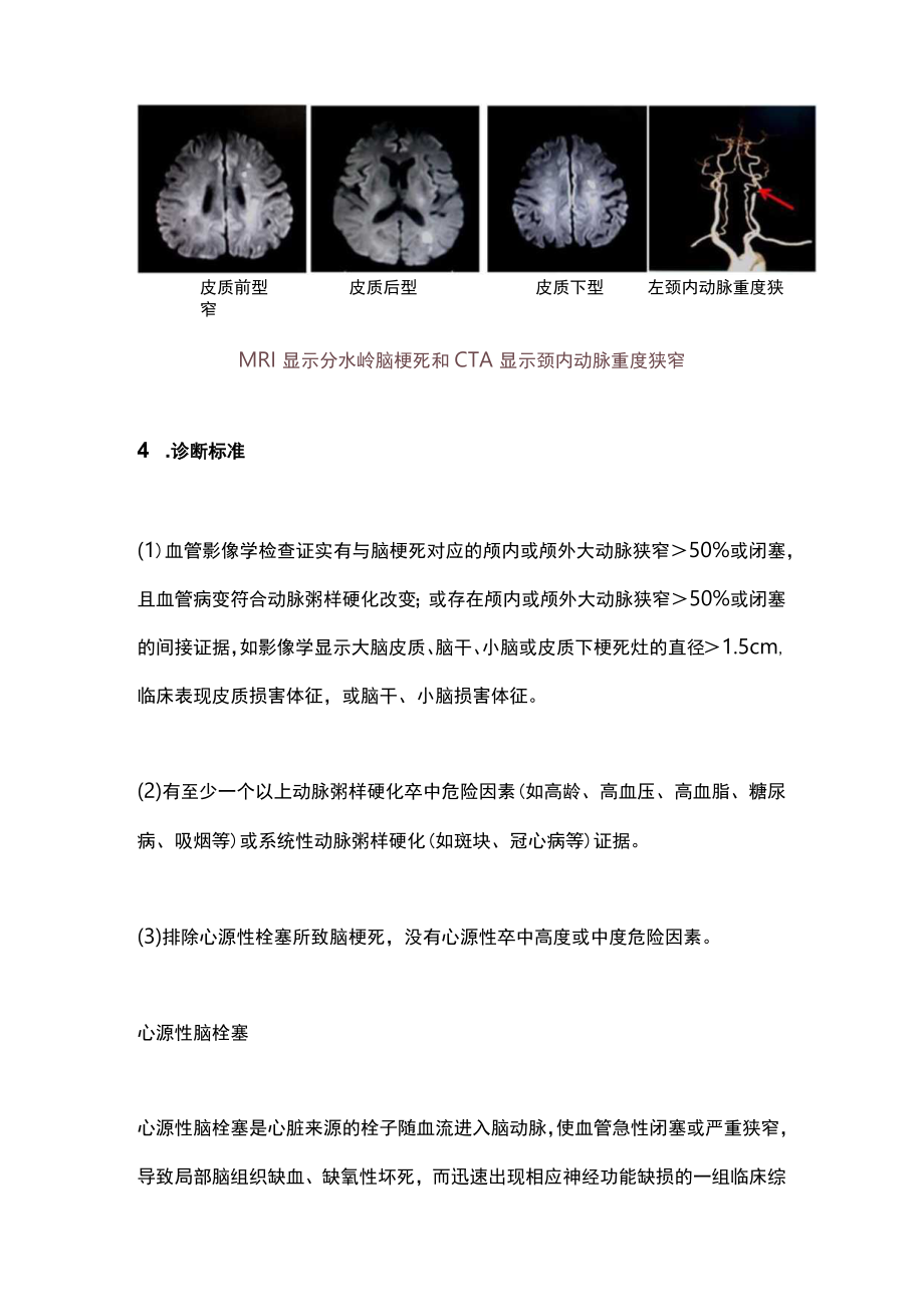 2023脑梗死常见临床类型特点及诊断标准（全文）.docx_第3页