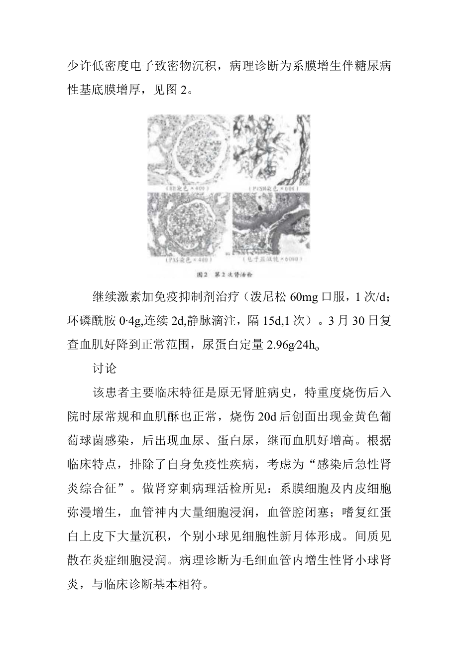 烧伤科特重度烧伤致感染后肾小球肾炎病例分析专题报告.docx_第3页