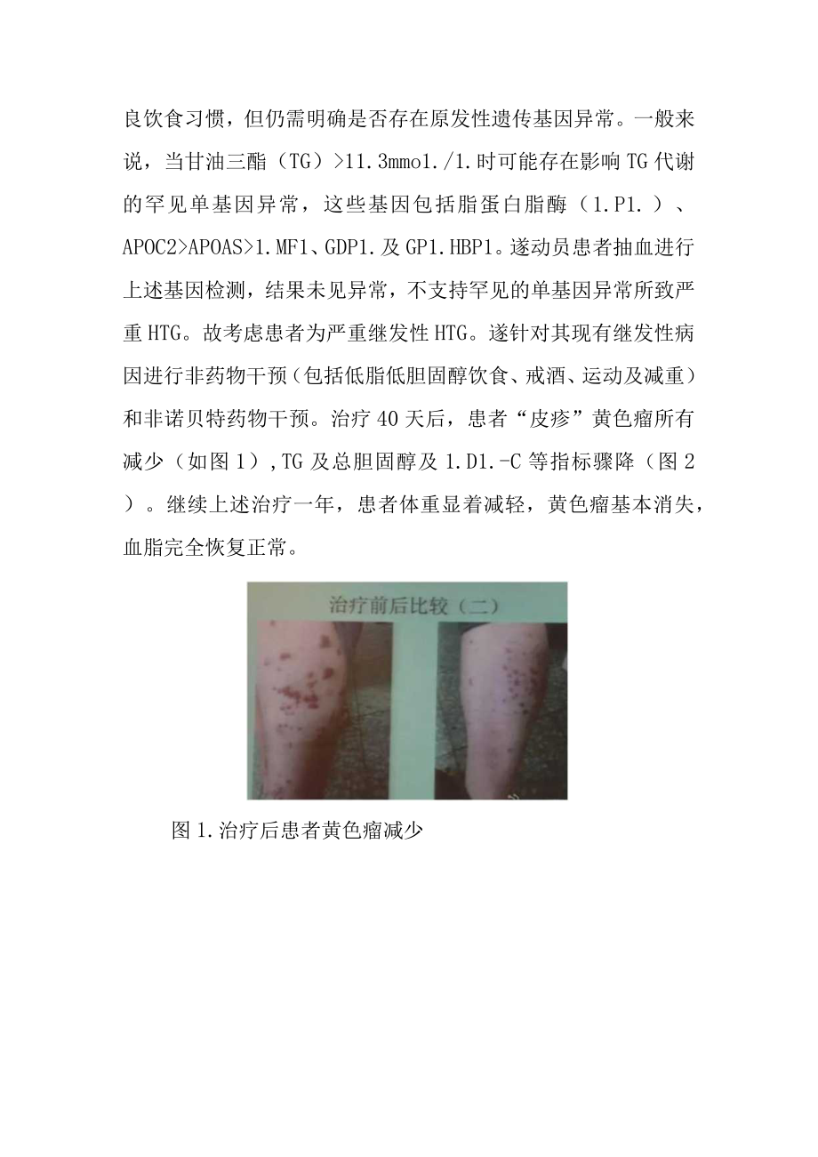 心内科严重继发性高甘油三酯血症病例分析专题报告.docx_第2页