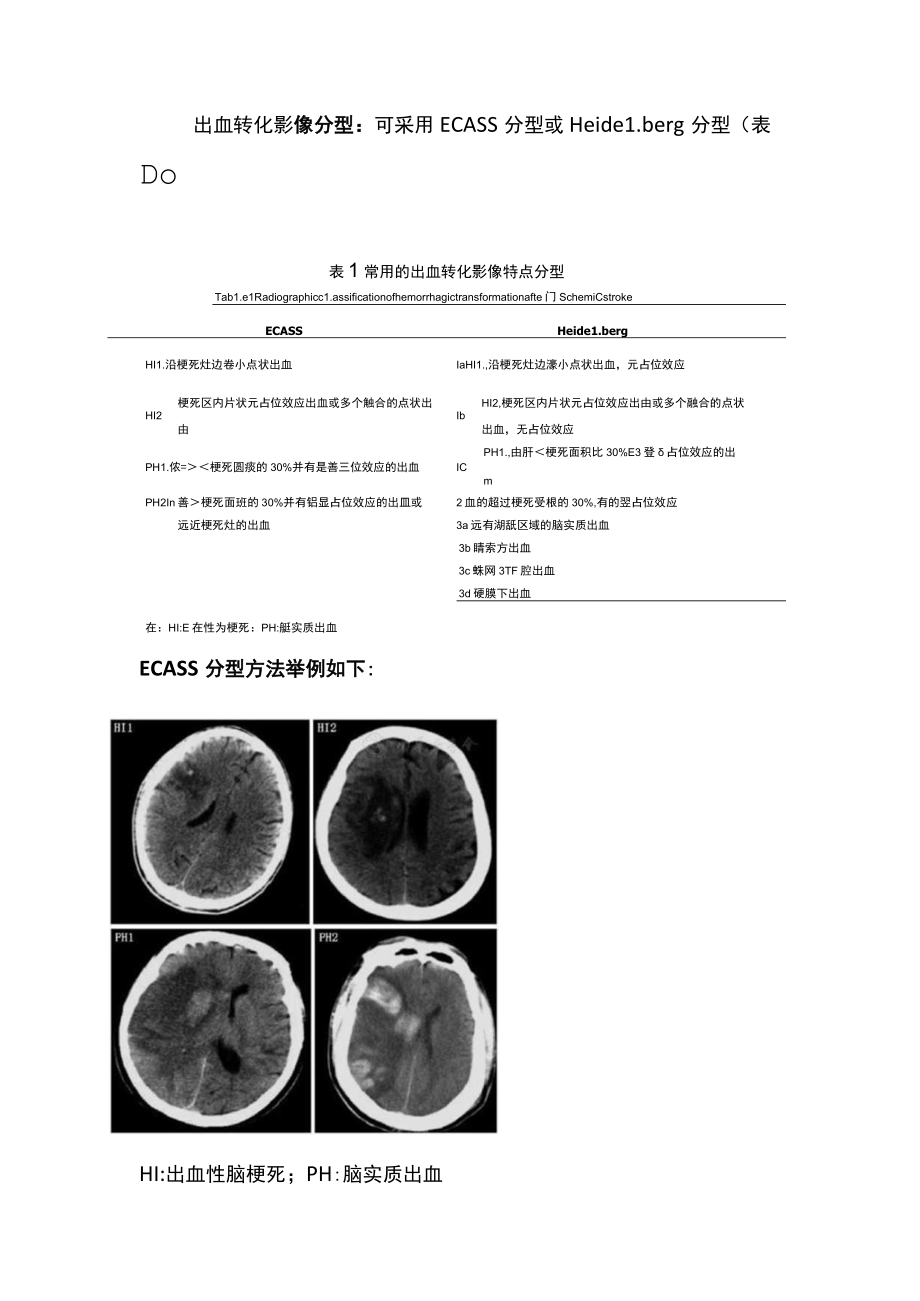 2022中国急性脑梗死后出血诊治专家共识（全文）.docx_第2页