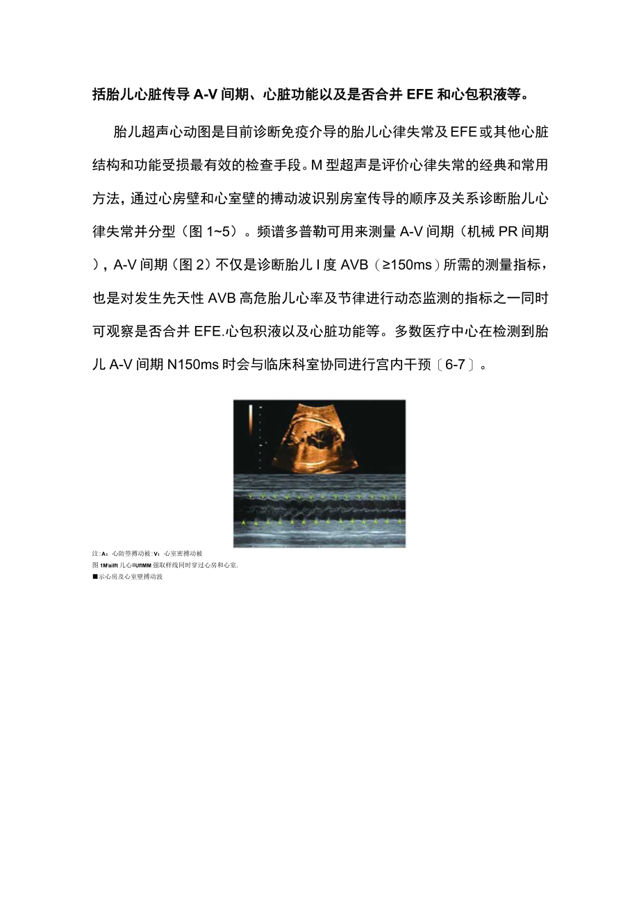 母体自身免疫性疾病和糖尿病胎儿心脏病围产期管理（全文）.docx_第3页