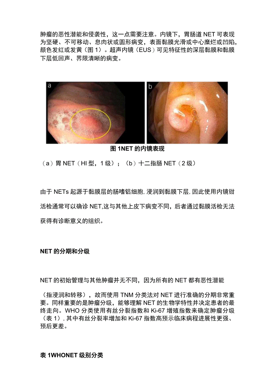 2023胃肠道神经内分泌瘤.docx_第2页