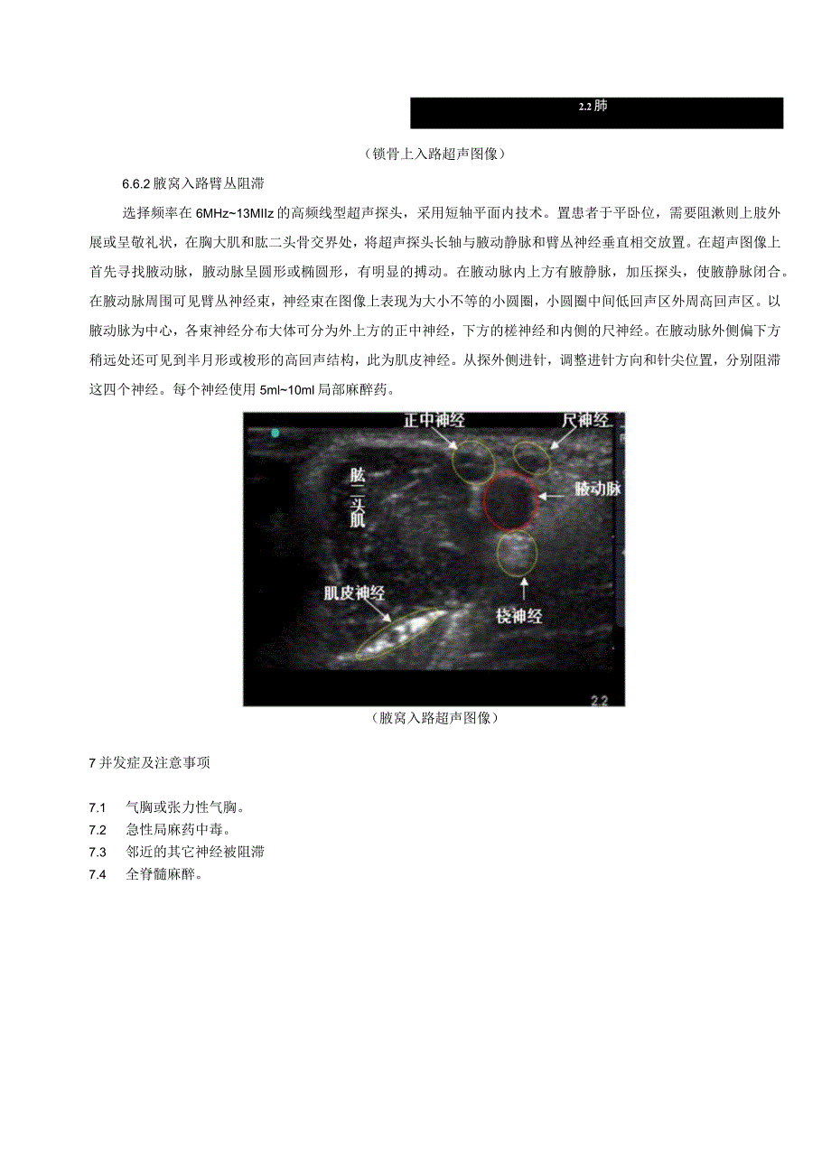 超声引导下臂丛神经阻滞技术操作规范.docx_第3页