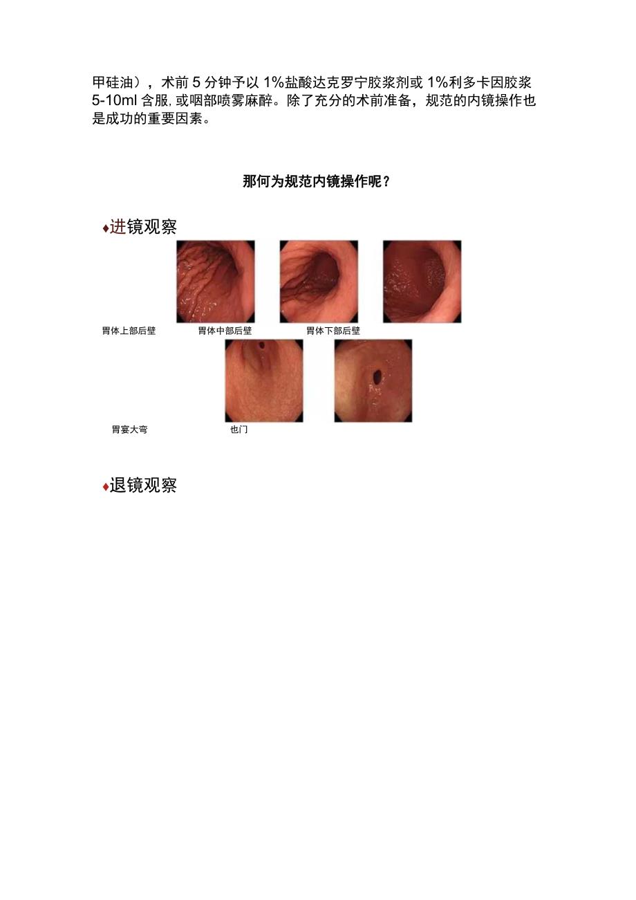 2023早期胃癌的规范化内镜诊断.docx_第3页