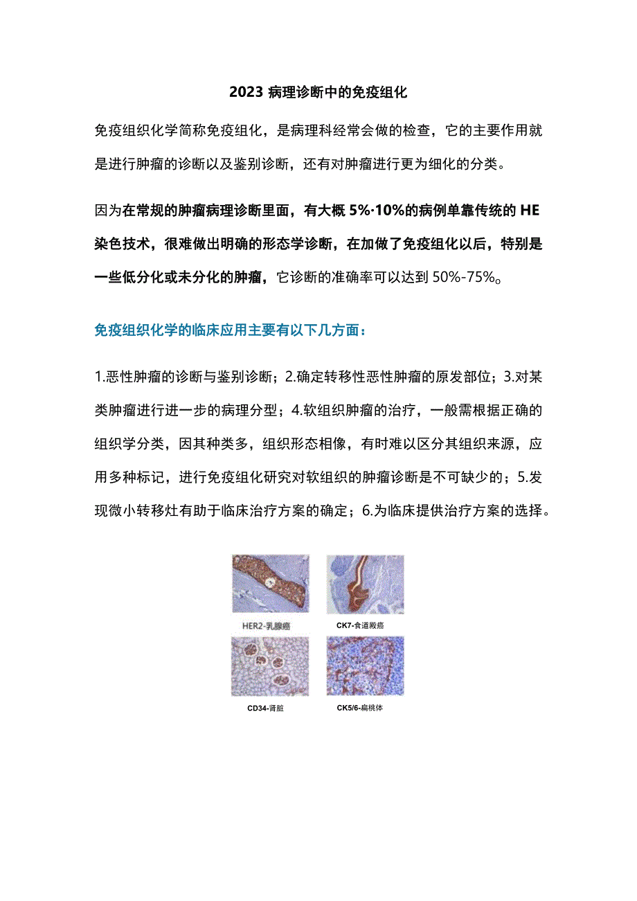 2023病理诊断中的免疫组化.docx_第1页