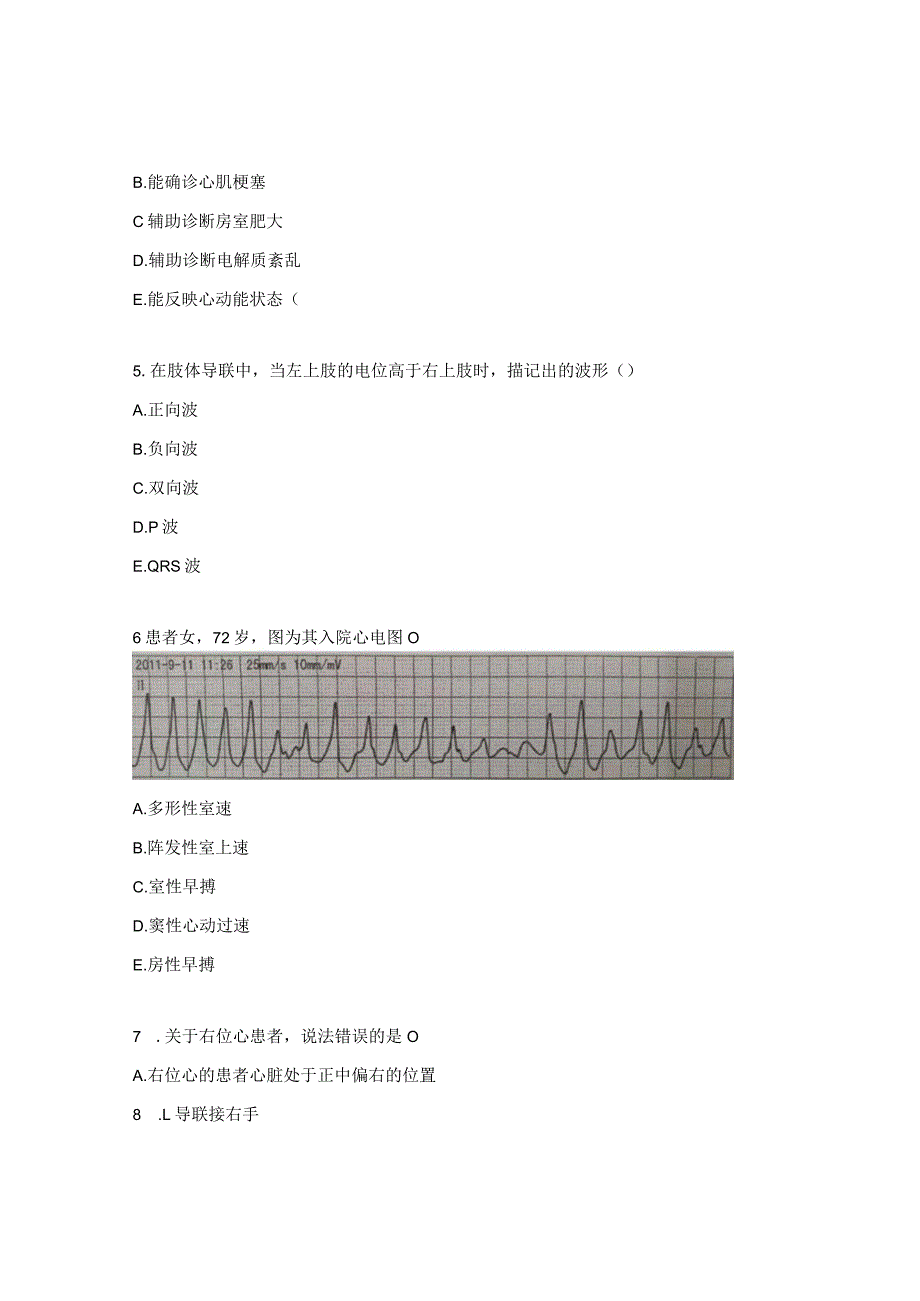 常见异常心电图正确率识别试题.docx_第2页