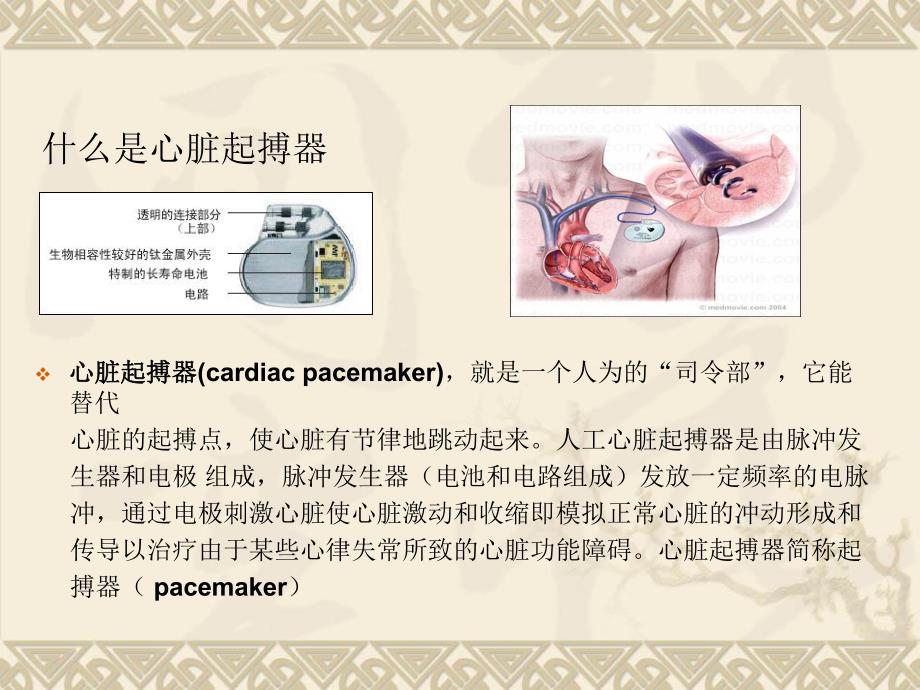 起搏器的护理.ppt_第2页