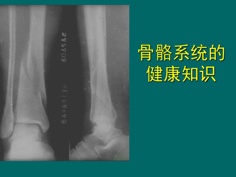 骨骼系统健康知识J.ppt_第1页