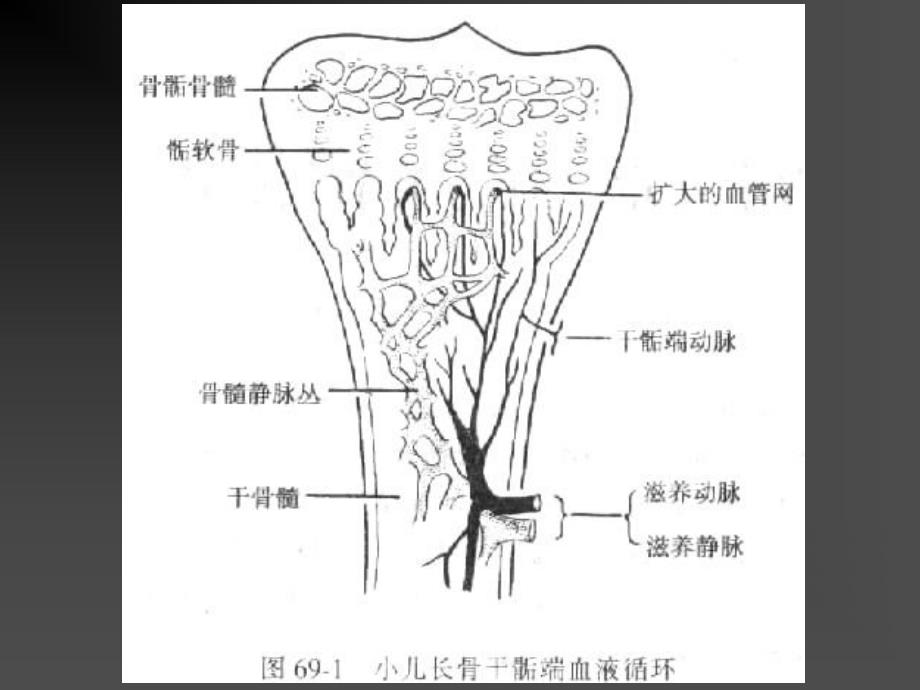 骨与关节化脓性感染化脓性骨髓炎pyogenicosteomyelitis概.ppt_第3页