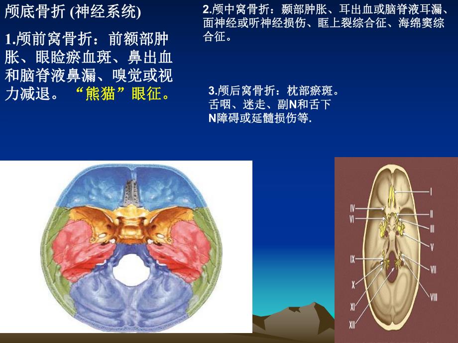 颅底中英文孔口诀.ppt_第3页