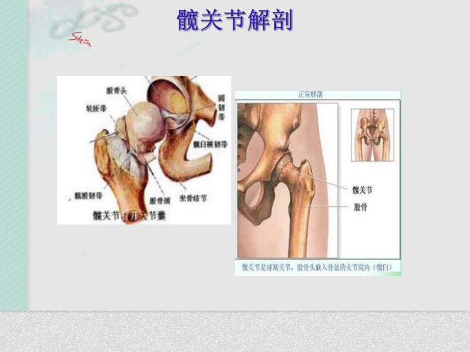 髋关节置换术后护理.ppt_第3页