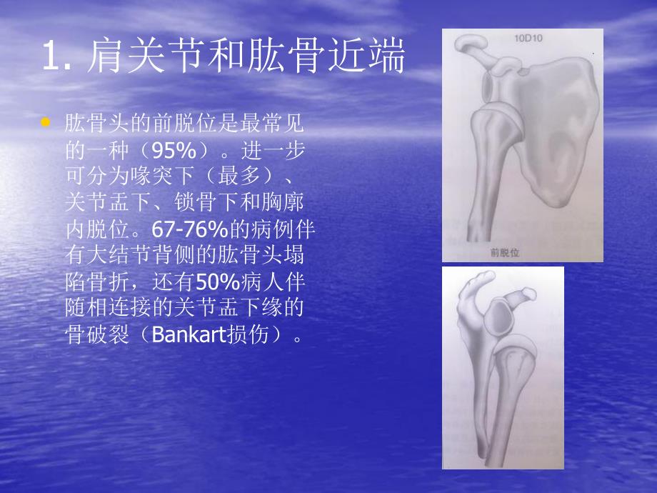 骨折与脱位诊断分型及治疗二.ppt_第2页