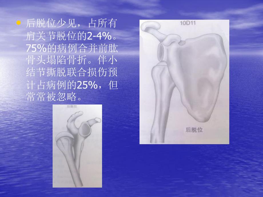 骨折与脱位诊断分型及治疗二.ppt_第3页