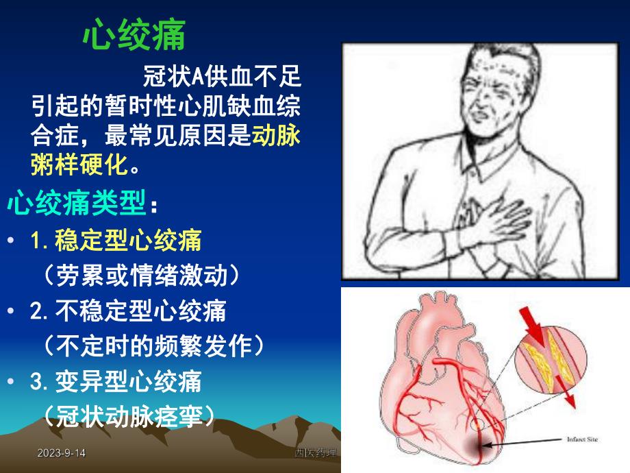 西医药理学第十六章抗心绞痛药.ppt_第2页