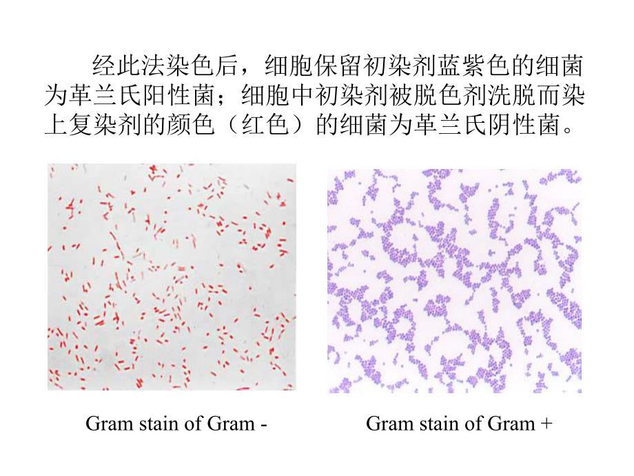 革兰氏染色及油镜的使用.ppt_第2页