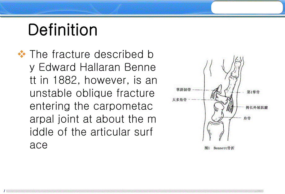 陈旧性bennett骨折的处理.ppt_第2页