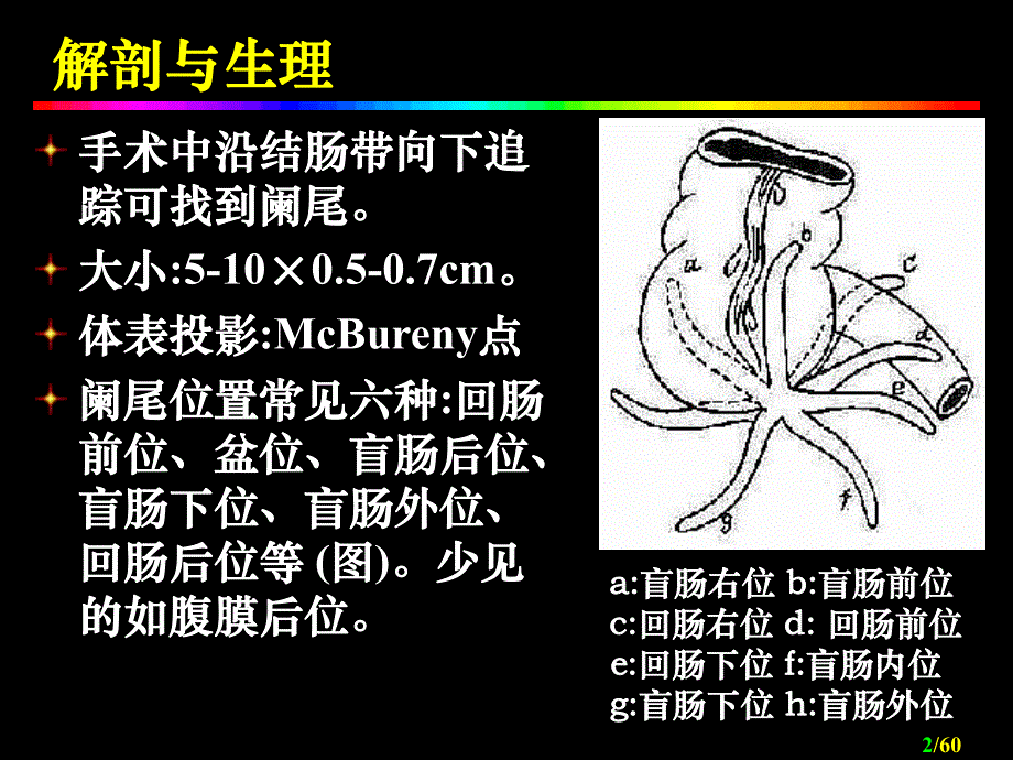 阑尾炎Acuteappendicitis.ppt_第2页