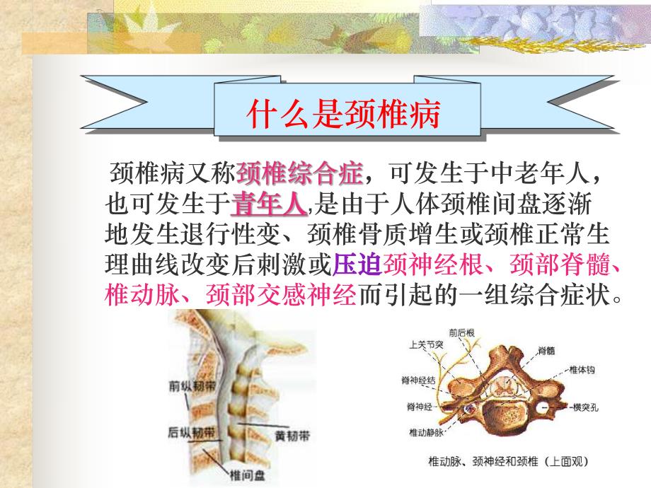 颈椎病的预防.ppt_第2页