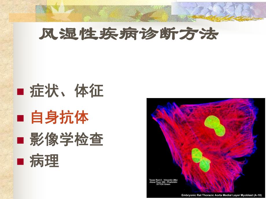 风湿性疾病中自身抗体的意义.ppt_第2页