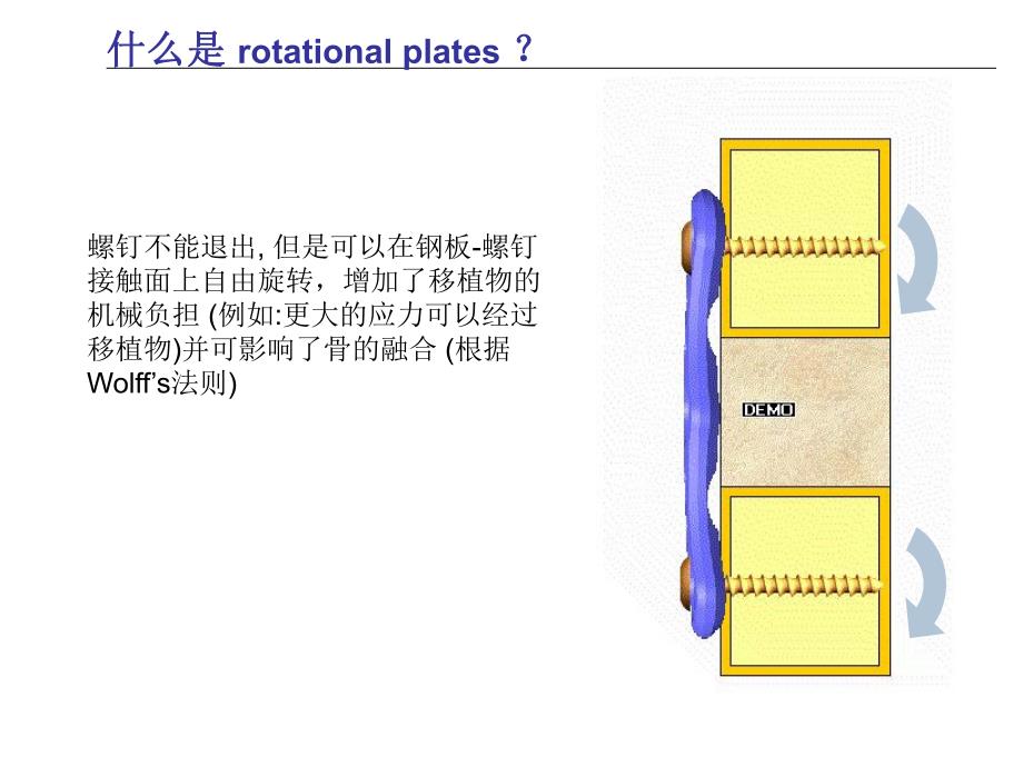 颈前路动力钢板Vectra.ppt_第3页