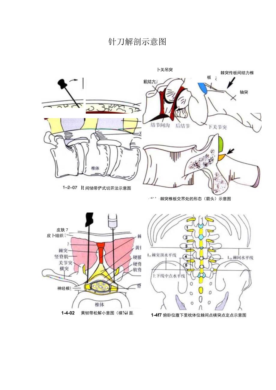 针刀医学《针刀解剖示意图》.docx_第1页