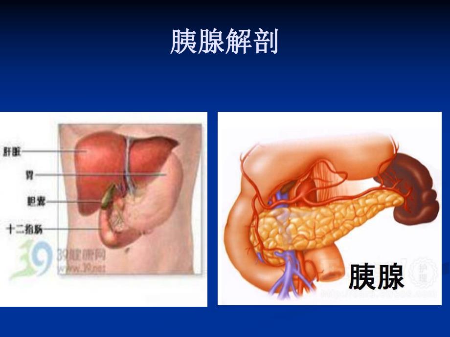 高脂血症性胰腺炎图文.ppt_第1页