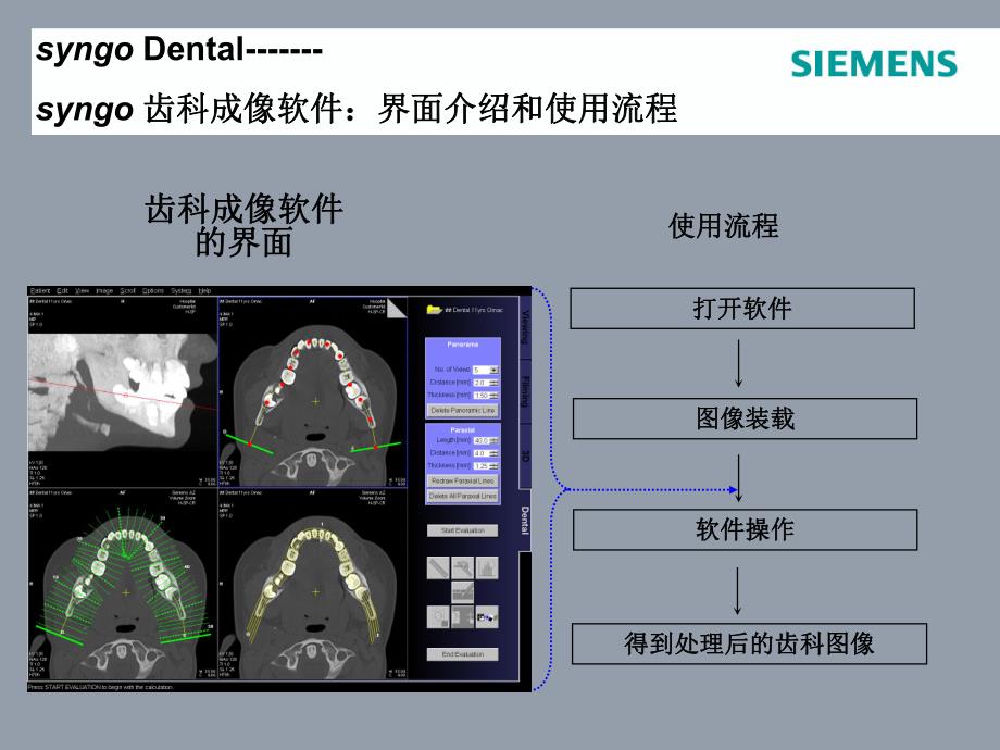 齿科成像软件Dental.ppt_第2页