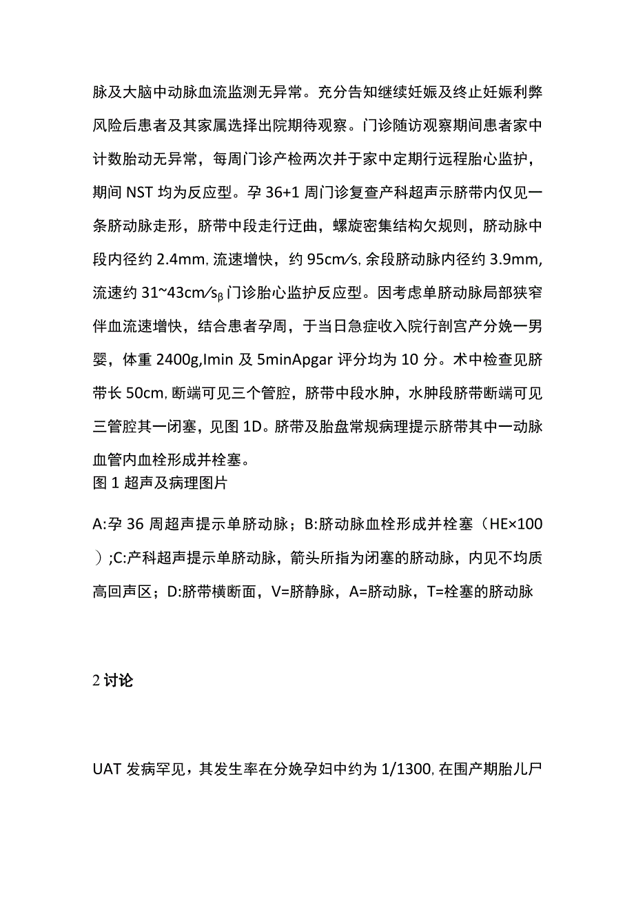 胎儿脐动脉栓塞期待治疗病例分析专题报告.docx_第3页