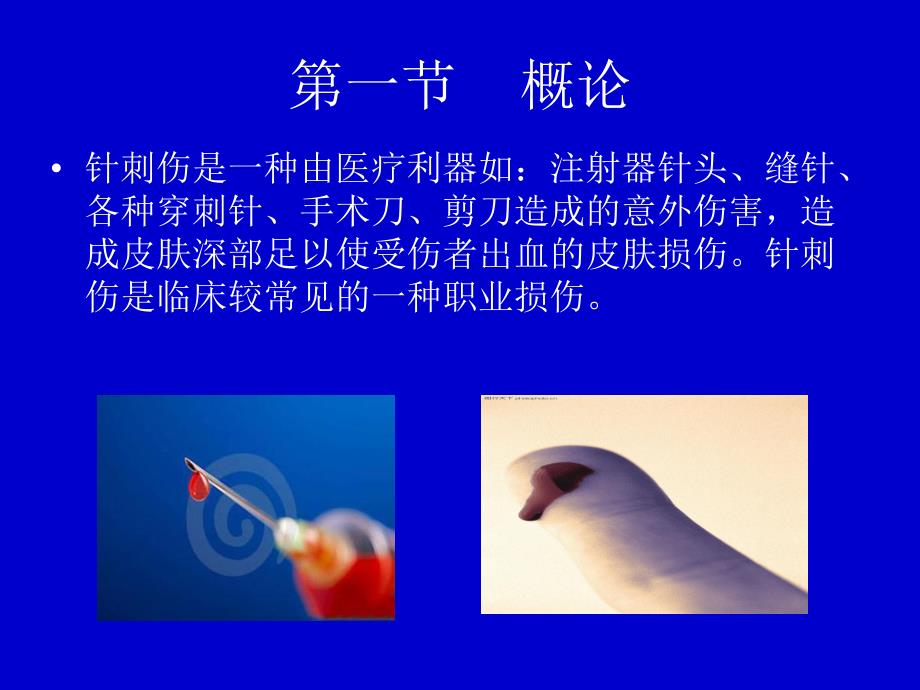 护理针刺伤pdca.ppt_第3页