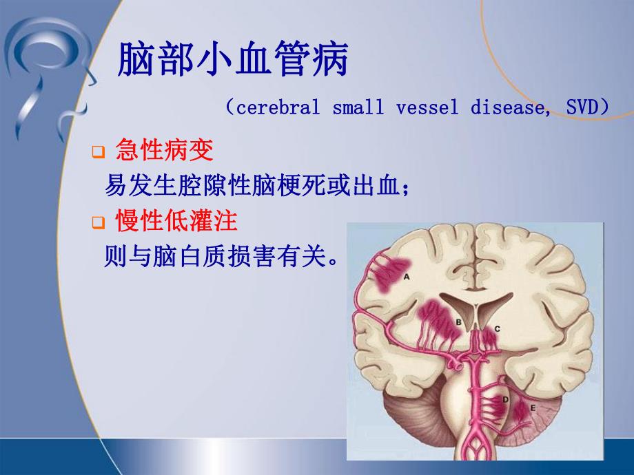 脑小血管病与腔隙性脑梗死.ppt_第3页