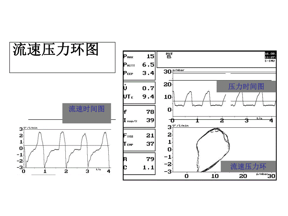 呼吸麻醉教学资料呼吸曲线及环的简要介绍.ppt_第3页