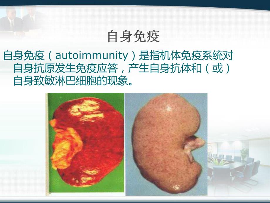 肺出血与肾炎综合征.ppt_第2页