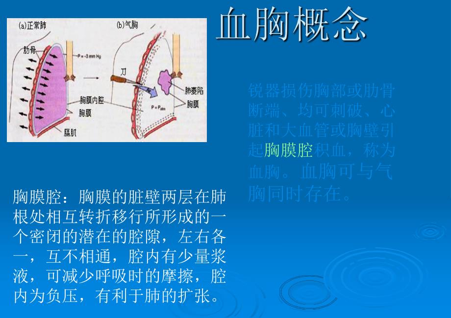 血胸护理ppt课件.ppt_第2页